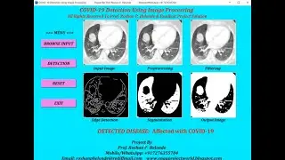Covid-19 Detection Using Image Processing | With Source Code | Python OpenCV Tensorflow Project