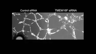 TMEM16F deficiency impairs endothelial tube formation.