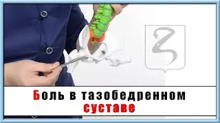 БОЛЬ В ТАЗОБЕДРЕННОМ СУСТАВЕ