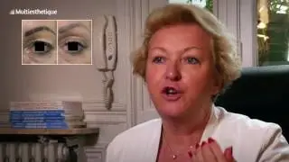 Blépharoplastie médicale : une technique non invasive pour rajeunir – Dr Catherine de Goursac