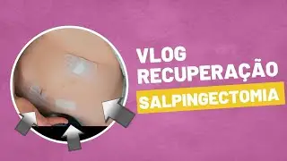 VLOG RECUPERAÇÃO SALPINGECTOMIA POR VIDEOLAPAROSCOPIA - LAQUEADURA ESTERILIZAÇÃO FEMININA