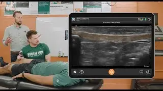 5 BENEFÍCIOS do CLARIUS em MSK