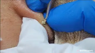 沉浸式針清 SaMuu Beauty香港美容店