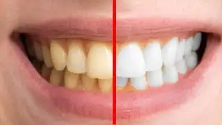 Photoshop İle Diş Beyazlatma - Photoshop Eğitimi