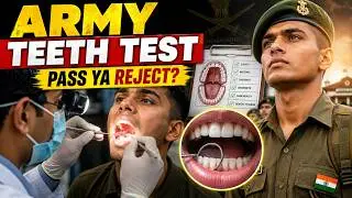 𝐈𝐧𝐝𝐢𝐚𝐧 𝐀𝐫𝐦𝐲 𝐓𝐞𝐞𝐭𝐡 𝐌𝐞𝐝𝐢𝐜𝐚𝐥 𝐓𝐞𝐬𝐭 In Hindi | आर्मी में दाँतो का मेडिकल टेस्ट कैसे होता है? 𝐈𝐧𝐝𝐢𝐚𝐧 𝐀𝐫𝐦𝐲