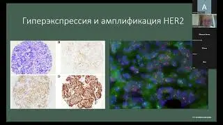Ольга Гордеева  «Онкология простыми словами: что мы знаем про опухоли и как это помогает их лечить.»
