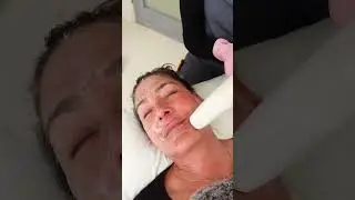 Sofwave | Alicia Coppola @alicia_coppola