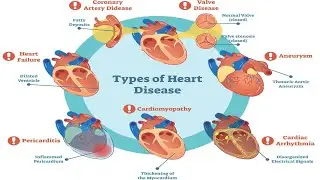 ASSESSMENT & DIAGNOSTICS 89: Heart Disease, Nausea & Vomiting, Heat Blocking the Pericardium