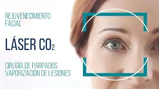 Láser de CO2 tratamientos. Cirugía de párpados, vaporización de lesiones y rejuvenecimiento facial.