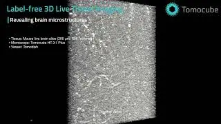 Brain Microstructures - Label-free 3D Live Tissue Imaging