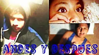de feo a algo mejor/antes y despues/Skes