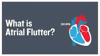 What is atrial flutter?