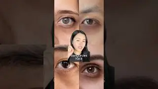How to cover up dark circles without concealer ☝️🤓