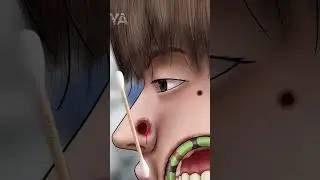 ASMR Cleaning big hole swollen face piercings | Removal animation | REVERSE VIDEO 02