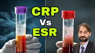 CRP Vs ESR Key Differences | MLT Hub with kamran
