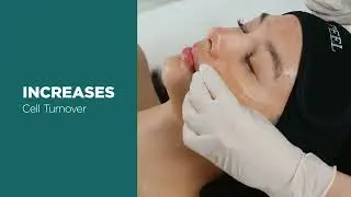 Discover the Benefits and Process of Our VI Peel! ✨ #VIPeel #SkincareMagic #GlowingSkin