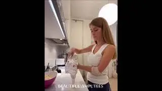 beautiful arm amputee 2