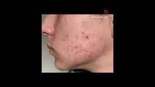 ДО и ПОСЛЕ ЛЕЧЕНИЯ у доктора Юдиной М.М.