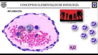 CONCEPTOS ELEMENTALES DE PATOLOGÍA II
