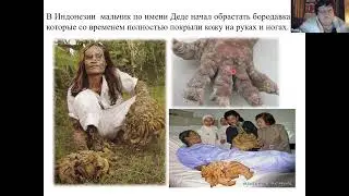 Вірус папіломи людини. Фальсифікація чи реальність