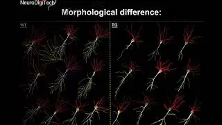 3D Neural Morphometrics