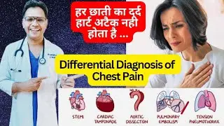 Differential Diagnosis of Chest Pain #cardiology #heartattack