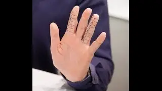 Ein Mythos: Das Zeige-/Ringfinger-Verhältnis - Vince und Dr. Nö