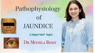 Pathophysiology of #jaundice l #mbbs  #neetpg #robbins #LIVER PATHOLOGY series PART 3