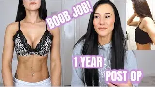 BOOB JOB | CAN I STILL WORKOUT? | 1 YEAR POST OP