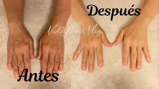 Cómo Mantener tus Manos Jóvenes y Bellas Siempre / Blanquea y Rejuvenece al Instante