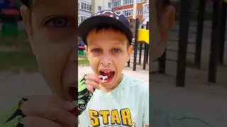 omg 😲 😱 #funny #shorts