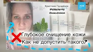 Чем я спасла кожу и теперь не за что не убираю из своего ухода #спаслакожу #кожа #уход #прыщиналице
