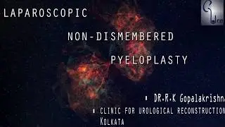 Laparoscopic Non-Dismembered Pyeloplasty with Preop & Postop Images