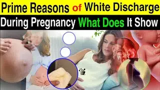 BIG Sign - Why WHITE Discharge Happens In Pregnancy 