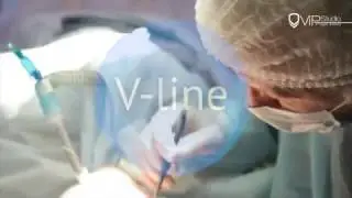 v-line. Уменьшение нижней челюсти.