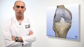 Lesiones del cartilago articular   3 10 16