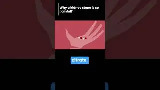 why a kidney stone is so painful #shorts