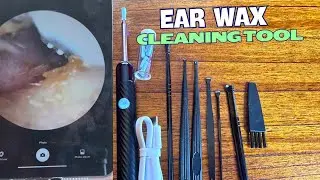 My thoughts on this Ear Cleaning Tool. Is it worth it?