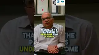 Causes of stricture in the urethra | Dr. Kumar Prabhu