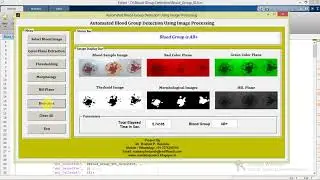 Blood Group Detection Using Image Processing Matlab Project Code