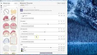20241112-Exocad Default Parameters Settings Change