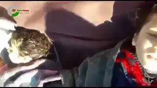 якобы уже мертвая жертва химической атаки в Хан Шейхуне открывает глаза и смотрит на оператора