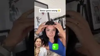 Eyebrows flew away because of Botox 