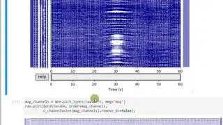 L10: Overview of artifact and noise detection in EEG/MEG