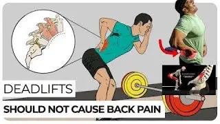 The Cause of Lower Back Pain After Deadlifts Injury L5 S1