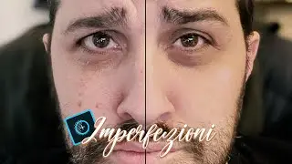 Tutorial | Remove Skin Imperfections From Photos With Your Smartphone!