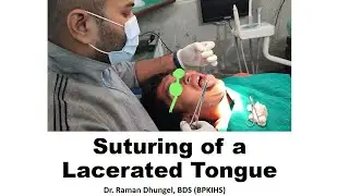 Suturing of a Tongue Bite Injury - Dr. Raman Dhungel