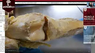 Chondromalacia Patellae Dr Vizniak