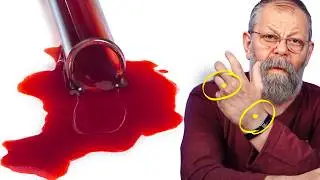 РАЗЖИЖАЮЩЕЕ ВСЕМИ ЗАБЫТОЕ СРЕДСТВО! Этот... поможет забыть навсегда о тромбах и густой крови!