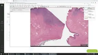 Whole Slide Images for Diagnostic Pathology